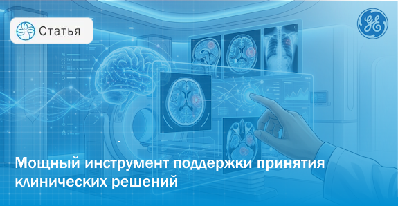 Искусственный интеллект в лучевой диагностике: заменит врача или станет главным помощником?